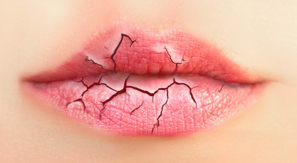 ¿Por qué se resecan los labios en la cuarentena? 1 resequedad labial