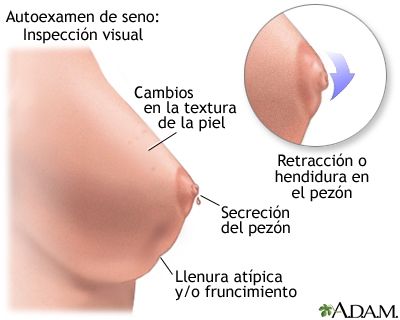 ¿Por qué te siguen hablando del autoexamen de mama? 2 17019
