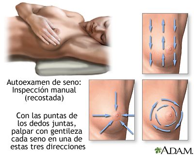 ¿Por qué te siguen hablando del autoexamen de mama? 1 17022