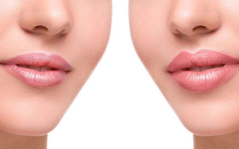 labios 2 805x503 1