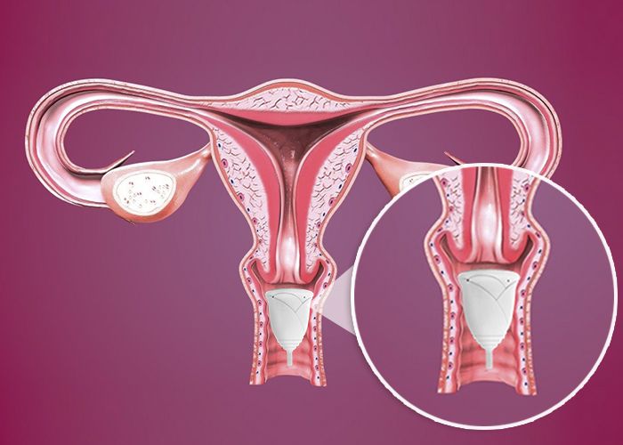 medir vagina con copa menstrual