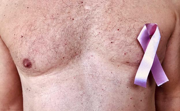 CancerMamaHombre2