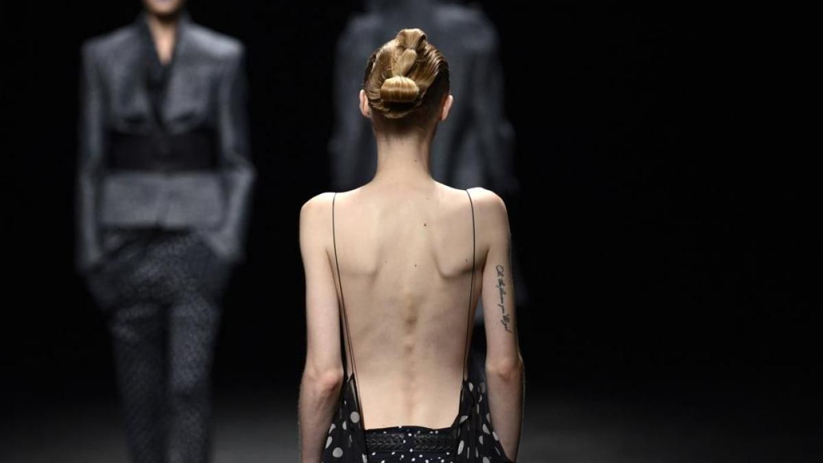 ¿La delgadez es sinónimo de belleza? 1 5fa3e261453e7