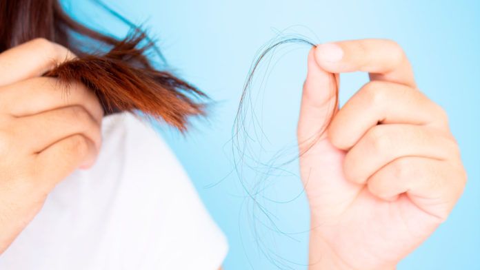 Pérdida de cabello
