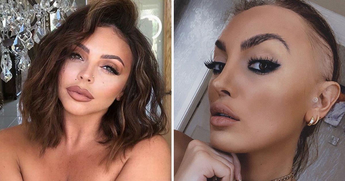 1 Celebrities whove opened up on their battles with alopecia