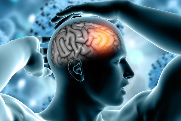 Tumores cerebrales benignos, conoce sobre esta afección 1 blog shaio que es un tumor cerebral