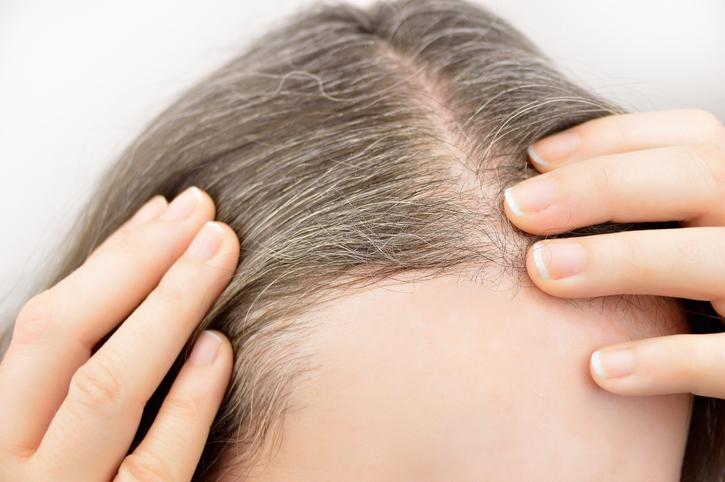 como evitar las canas 49794 orig