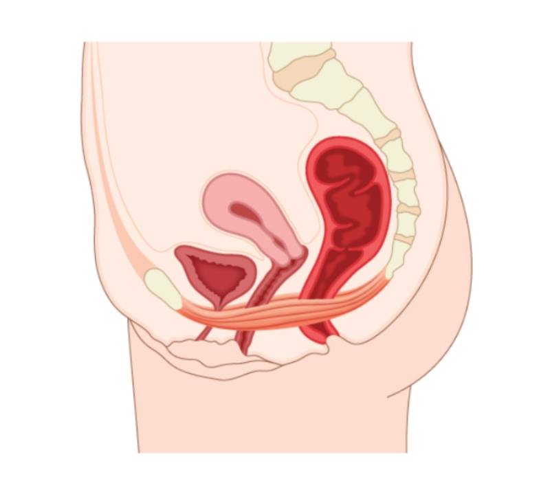 suelo pelvico