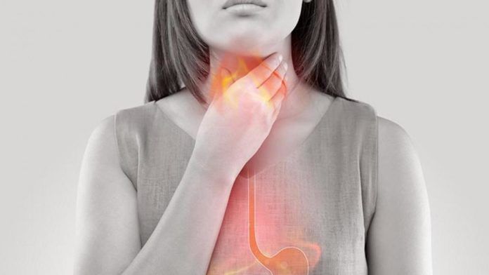 Enfermedad por Reflujo Gastroesofágico