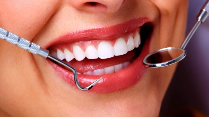 Diseño de sonrisa
