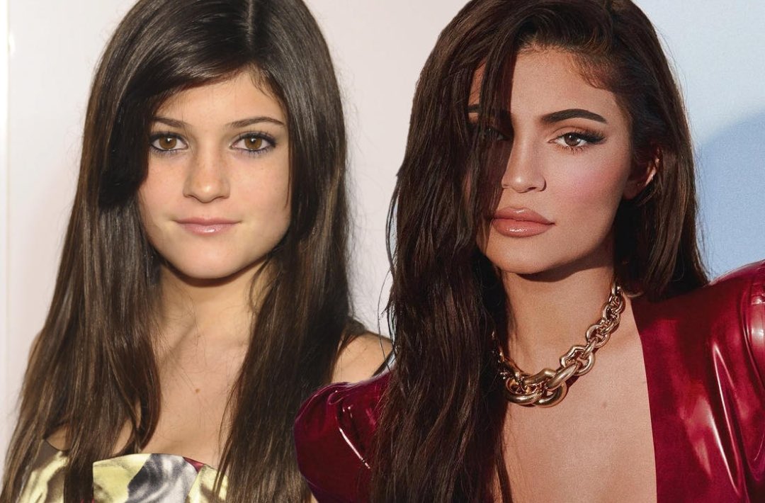 Kylie Jenner aborda el tema de las cirugías y confiesa la verdad 7 FuApB8PXwAgjI Y