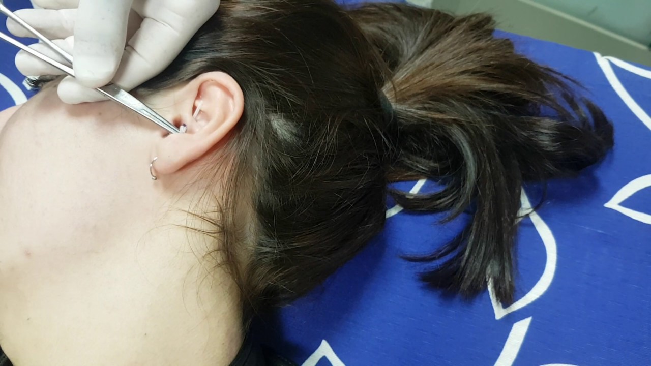 Daith Piercing: ¿Previene las migrañas? 1 daith piercing