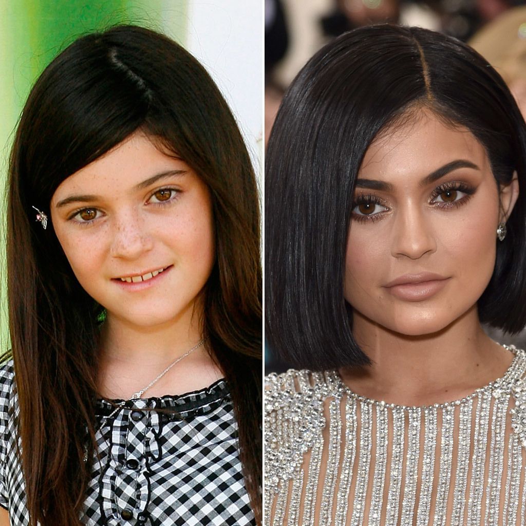 Kylie Jenner aborda el tema de las cirugías y confiesa la verdad 8 original leza belleza vip kylie jenner antes despues 12825279 1 esl es el antes y despues de kylie jenner jpg
