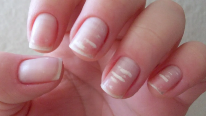 Uñas