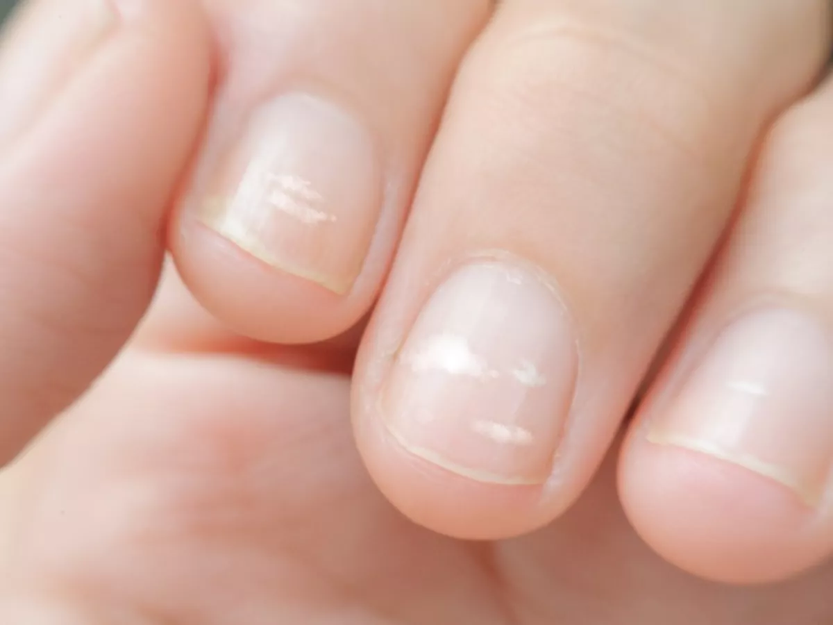 Uñas