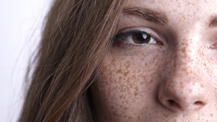 Pecas