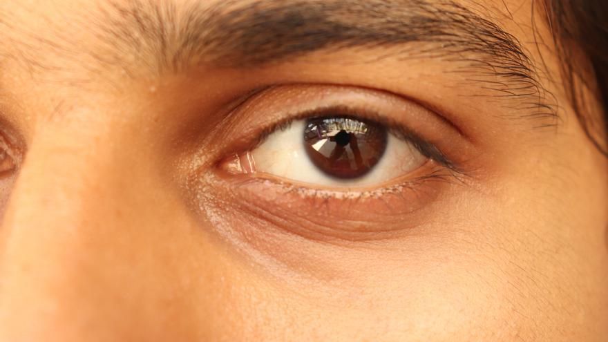 Ojeras