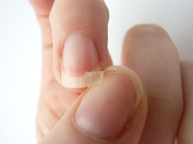 Trucos para tener uñas saludables y fuertes 2 uñas
