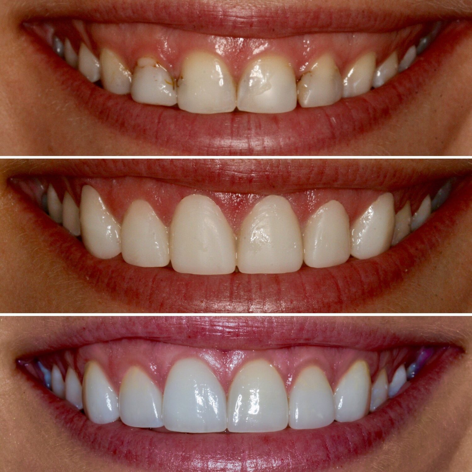 Armonización facial y Armonización orofacial: Belleza en equilibrio 12 1b27f6543a86d0e81d5d9a9b01b925f1