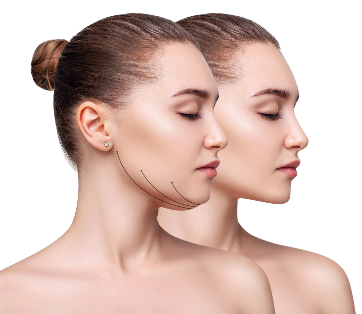 Armonización facial y Armonización orofacial: Belleza en equilibrio 10 AdobeStock 496369490