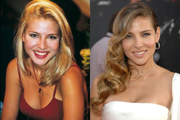 elsa pataky cirugias
