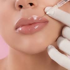 Armonización facial y Armonización orofacial: Belleza en equilibrio 1 images 5 3
