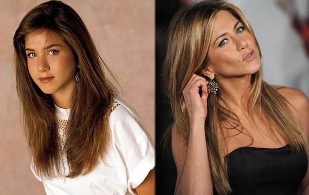 jennifer aniston cirugias