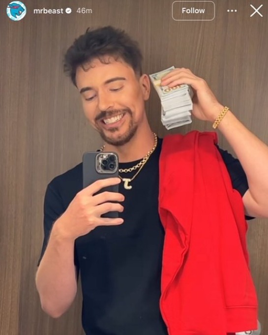 El increíble glow up de MrBeast 1 MrBeast
