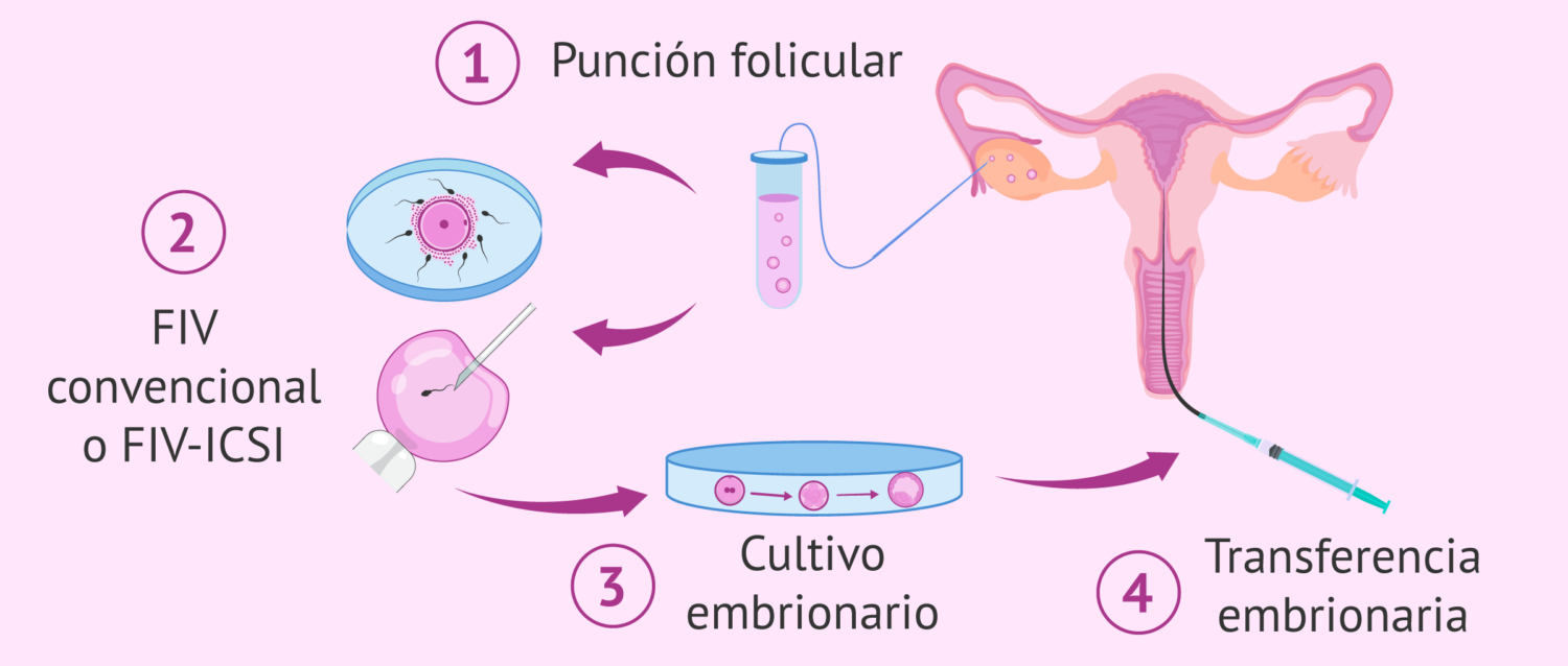 La Maternidad Asistida: Todo lo que debes saber antes de iniciar el proceso para ser madre 8 el procedimiento de la FIV